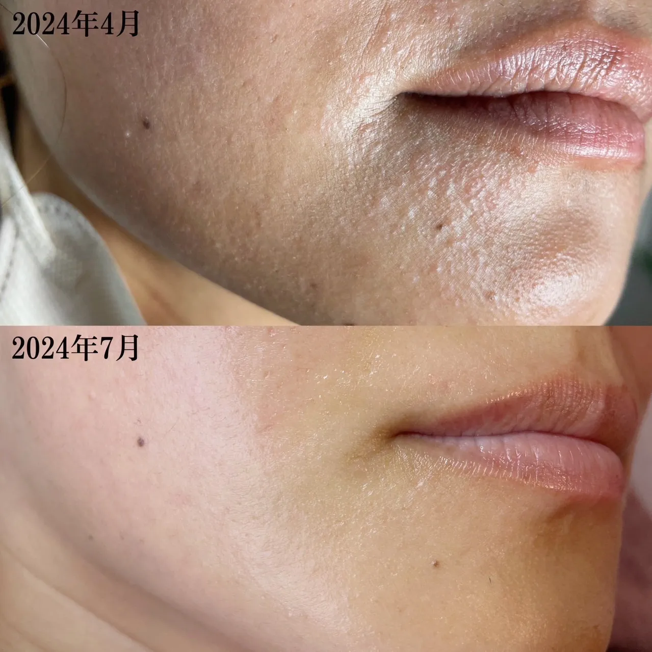 若さキープのカギは「垢をためない」こと★